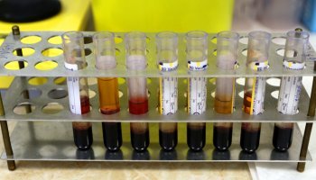 ΚΕΕΛΠΝΟ για Aids